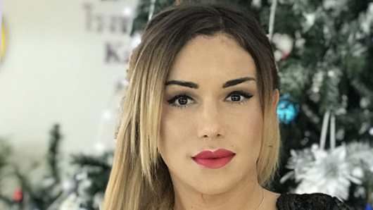 Phẫu thuật mặt exprerience, bởi Monica